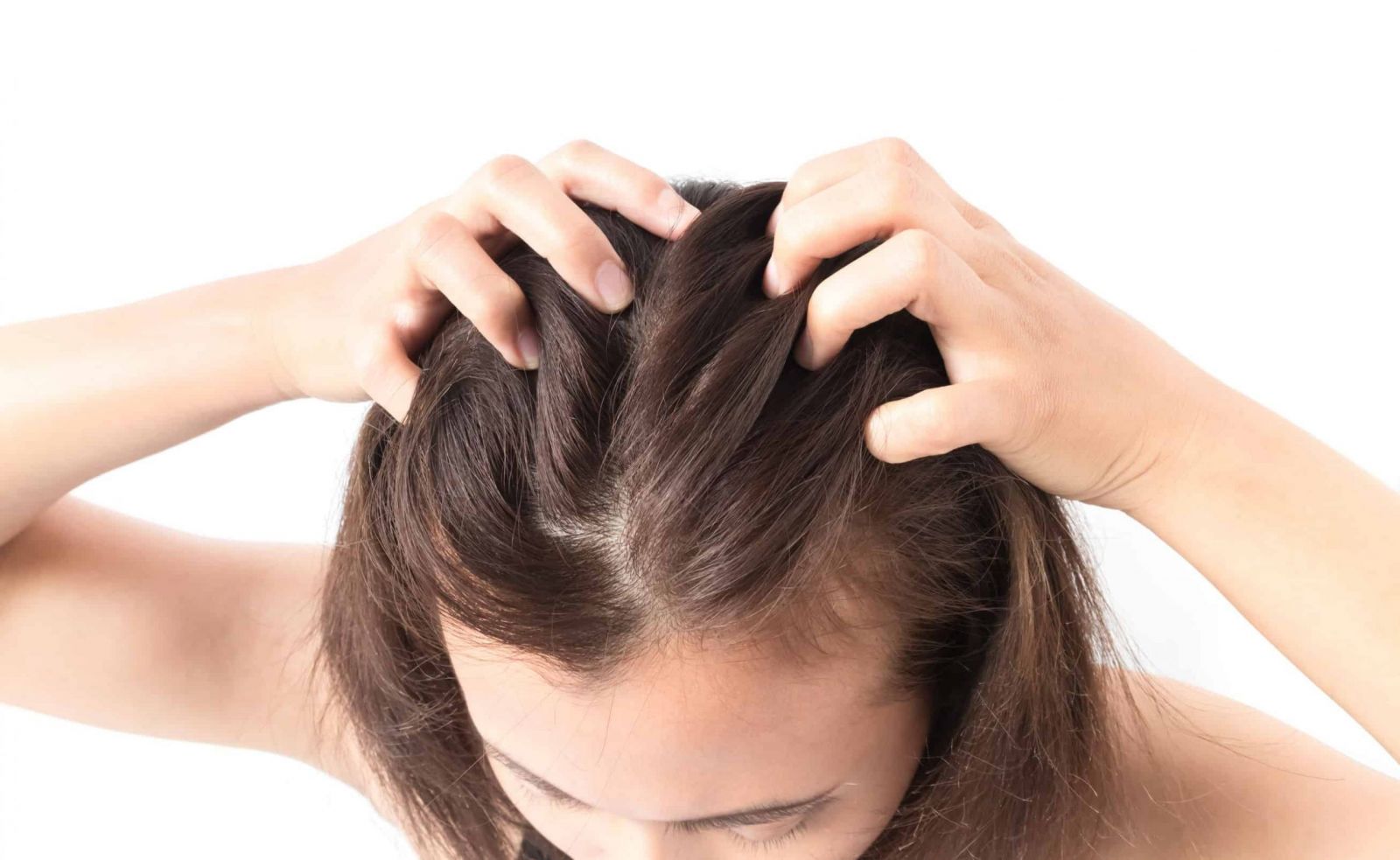 Những triệu chứng của ngứa da đầu là gì?